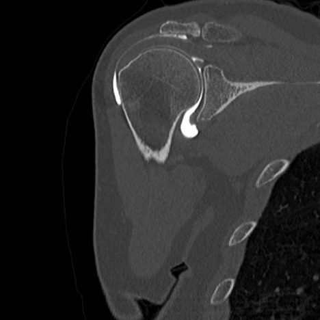 arthroscanner arthroscanner