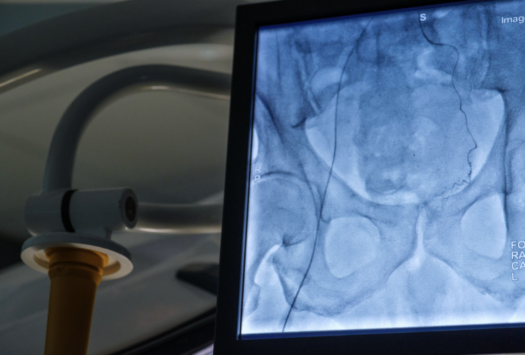 radiologie interventionnelle
