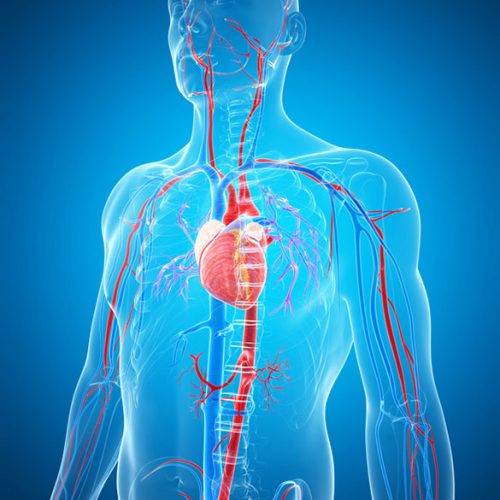 embolisation